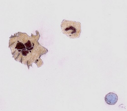 7.1.14 Sonnenfleck sunspot - Dr. Johannes Schilling, Lonsee